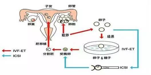 人工受孕中心： 正规与否可信赖？